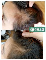 -博士园养发馆