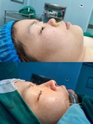 -Yestar宁波艺星整形医院