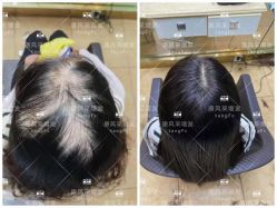 -唐风采假发补发定制