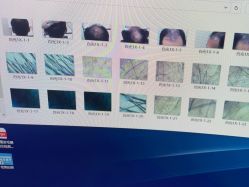 -雍禾植发全国连锁