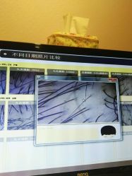 -菩叶头皮抗衰养发护发