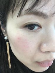 -杭州医巢医疗美容
