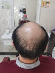 -唐风采假发补发定制