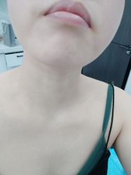 点击看大图 体验后-中加科洋医疗美容