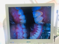 -众鑫医疗小白牙口腔(土桥店)