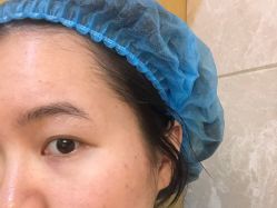 点击看大图 体验前-南京康美美容医院·旗舰店
