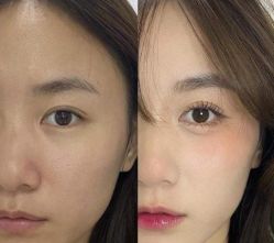 -紫洁俪方（北京）医疗美容