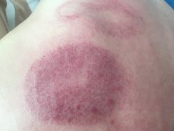 -skin79皮肤管理基站