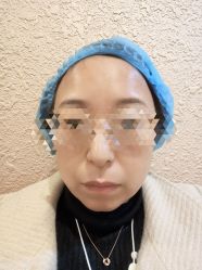 体验前-上海宏康医院·医疗美容科