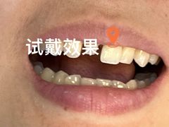 -四川大学华西口腔医院(华西院区)