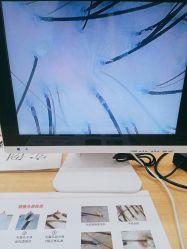 -岳灵生发养发馆