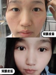 -素美医疗美容·西南眼鼻整形·修复基地