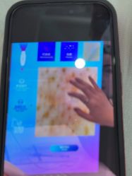 -SKIN79皮肤管理中心