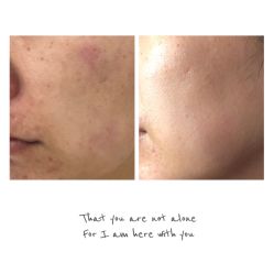 -夸迪QUADHA肌肤定制