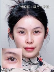 -深圳艺星医疗美容医院