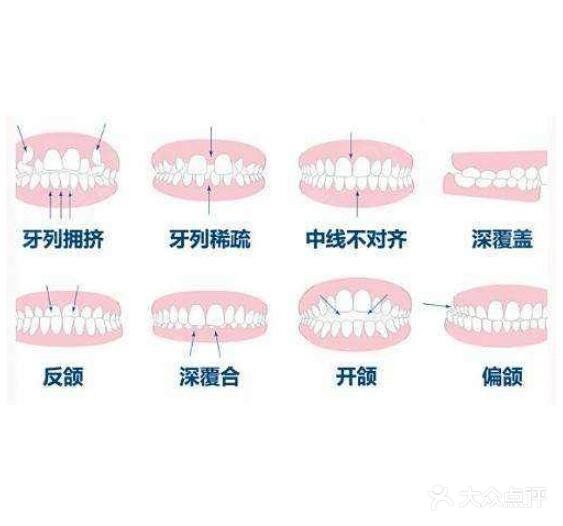 听说矫正牙齿会很痛？会不会伤害牙齿呢？
