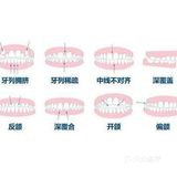 听说矫正牙齿会很痛？会不会伤害牙齿呢？