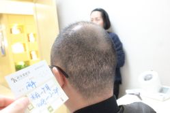 点击看大图 -大麦微针植发丨全国连锁
