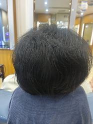 -大麦微针植发全国连锁