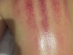 -益友堂盲人推拿正骨穴位按摩工作室