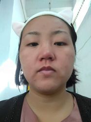 点击看大图 -痘博士广州·全国连锁祛痘机构