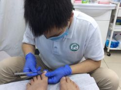 点击看大图 -德哥灰指甲脚气甲沟炎跖疣护理