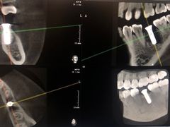 -泰康拜博口腔(世博园乐尔店)