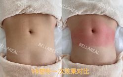 -BELLAREAL新美社