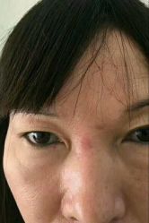 -北京美痣堂古方祛痣斑疣瘊