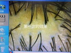 点击看大图 -新生植发·植养护一体