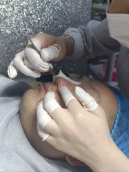 -痘庄科学祛痘国际连锁