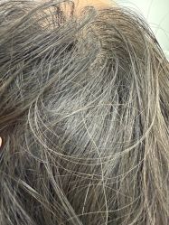 -熙朵美学植发·连锁品牌