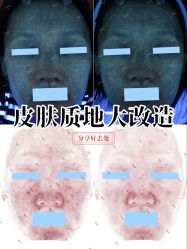 -海菲秀·飞顿牛奶光·LDM官方授权中心美轮美浣瓷感美肌