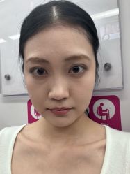 -天津健丽·去眼袋医疗美容机构
