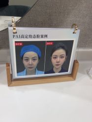 -深圳鹏爱秀琪医疗美容医院
