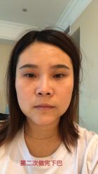 -新雅韩整形美容医院
