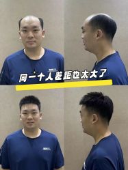 -唐风采假发补发定制