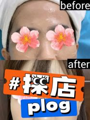 体验前-北京丽星翼美医疗美容