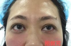 -天津健丽·去眼袋医疗美容机构