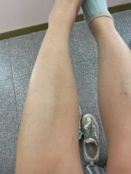 -MUSES专业脱毛日式比基尼サロン连锁