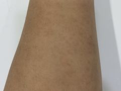 -首都医科大学附属北京天坛医院