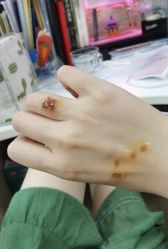 -秦好山专业洗纹身