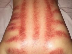 -鸿喜足健康足道采耳艾灸(南纬路店)