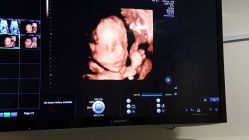 -杭州贝瑞斯美华妇儿医院·早孕·产检·儿科