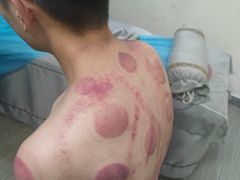 -张钰强中医正骨推拿连锁(唐家人才公寓店)