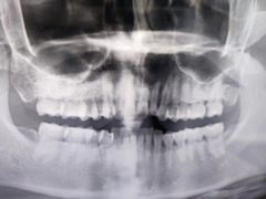 -同步齿科·数字化正畸种植口腔中心(前山店)