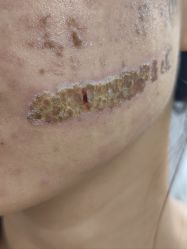 -深圳米兰柏羽医疗美容医院