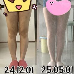 -Lily纤美·科技减脂中心