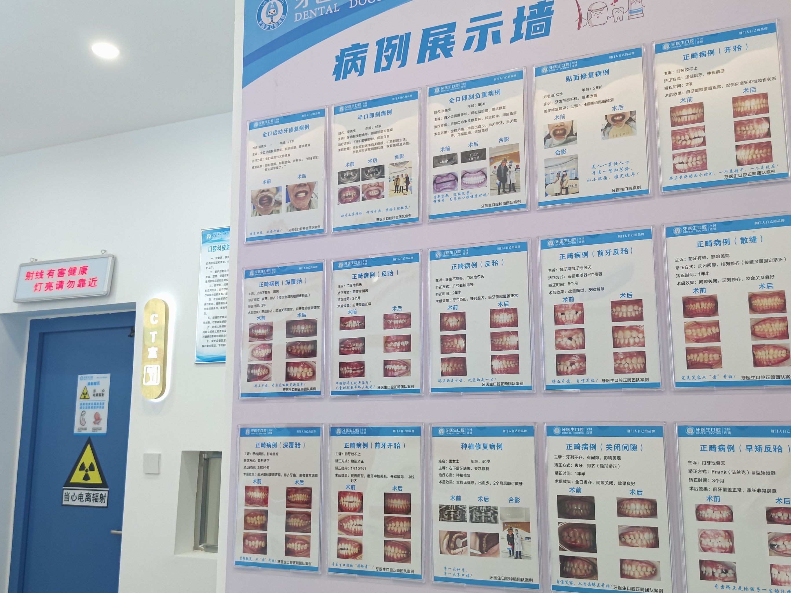 服务好,来洁牙体验感很好,以后会来定期洁牙