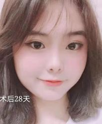 -广州健丽·去眼袋医疗美容机构